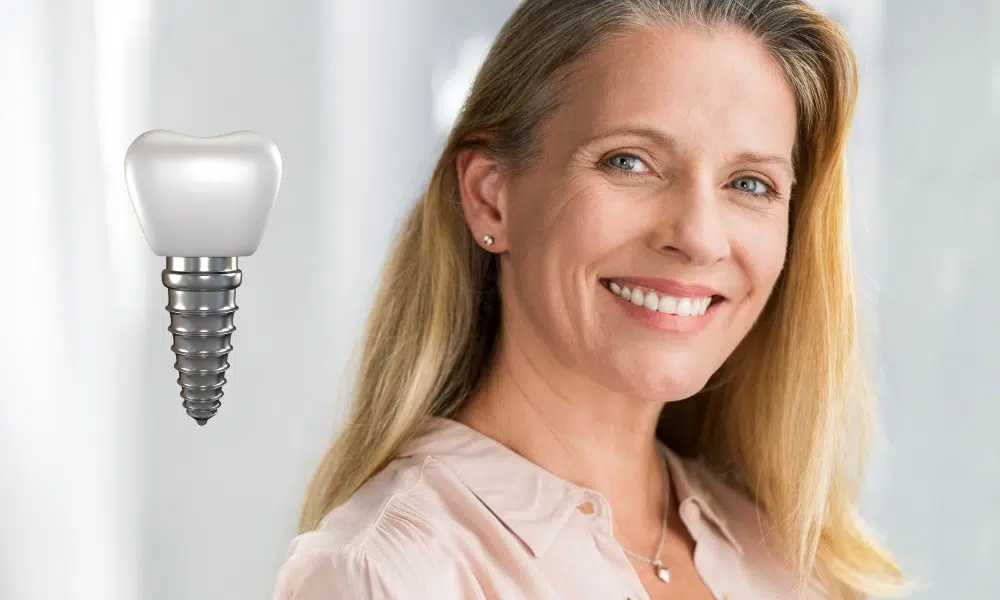 Dental Implants